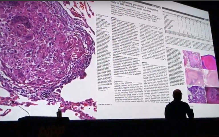 Silhouette of person teaching lecture in front of large screen showing radpath content