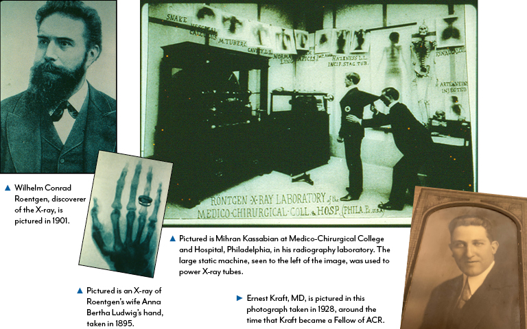 4 viintage photos, from early days of Radiology, for the ACR Centennial