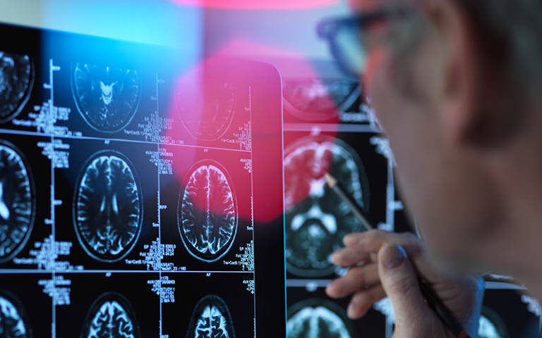 Radiologist reviews brainscans
