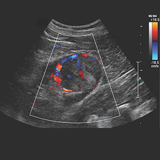 CPI Ultrasound Module Image