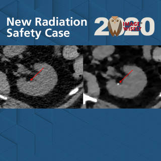 Image Wisely Radiation Safety Case Study