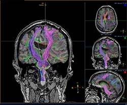 neuroradiology exam image