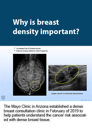 Breast density
