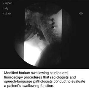 Modified Barium Swallow Study
