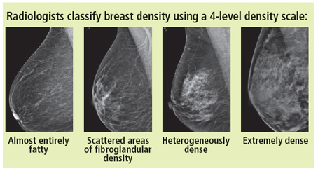 Mammography images depicting breasts with varying tissue density